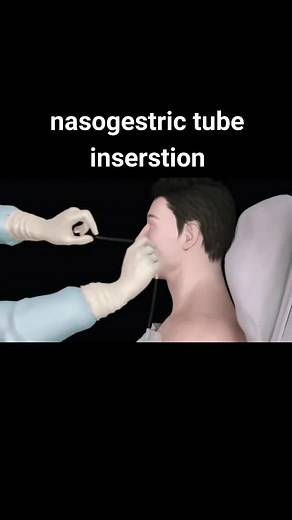 ###naso##tube