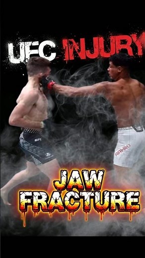 Tonight Harry Hardwick took a perfect shot from Marwan Rahiki that resulted in a #JawFracture #mma