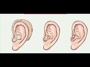 How To Pick The Hearing Aid Style That's Best For You