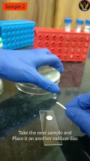Oxidase Test 🧫🧪🔬🦠| Biochemical#test | Microbiology Lab | Basics| Biology ThiNK VISION #biochemistry