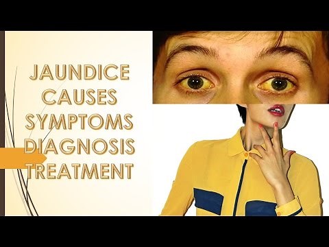 Jaundice Causes,Sign, Symptoms,Treatment and Risk Factor