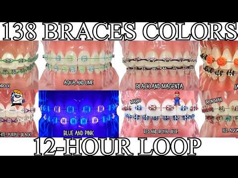1138 Braces Color Combinations | 12 Hour Looping Slideshow with music