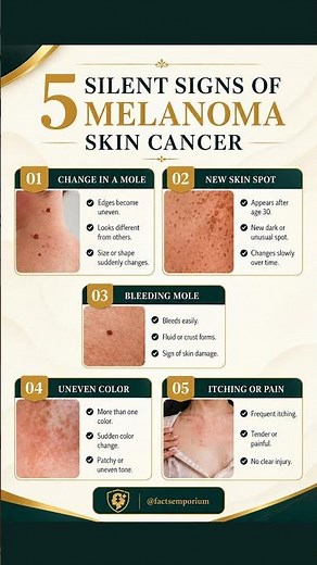 5 Silent Warning Signs of Melanoma Skin Cancer You Shouldn’t Ignore #healthylifestyle #healthtips