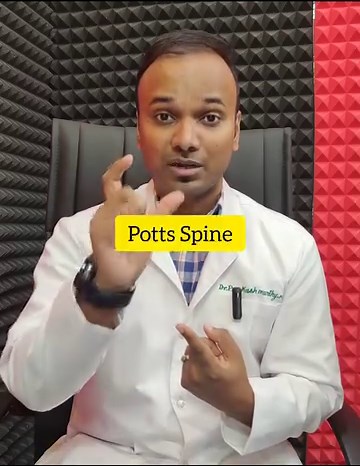 152K views · 1.7K reactions | Differential diagnosis for swollen cervical lymph nodes include Streptococcal infection, tonsillitis, scalp and ear infections, bronchitis, and not to forget Mycobacterium tuberculosis . #infectologia #healthcoach #tuberculosis #node #viral #viralfever #tonsilstones #ear #doctor #mbbs #md #fmge #neetpg #neet | Dr.Prakash Murthy MBBS MD | Facebook