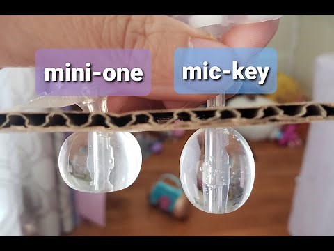 Tubie2go - Mini-One vs Mic-Key G-tube Button Comparison