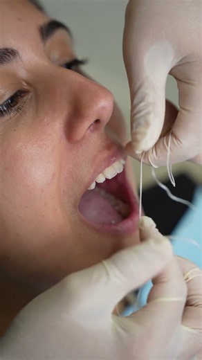 ¿Cómo utilizar el hilo dental?