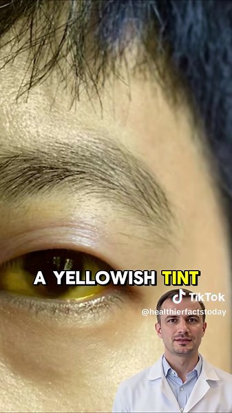 4 simple ways to check your liver at home. #liver #liverhealth #urinalysis