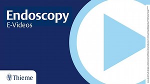 1.2K views | E-Video: Endoscopic ultrasound-guided gastrojejunopexy...