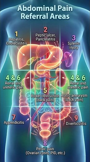 Stop Ignoring This! Abdominal Pain Map 🚩