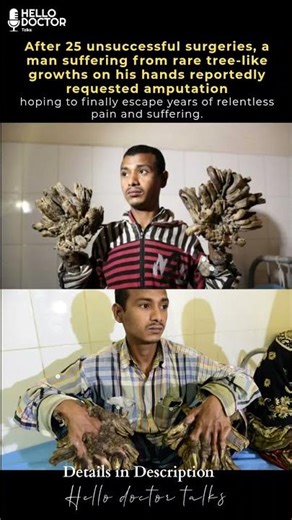 After 25 unsuccessful surgeries, the growths kept coming back…