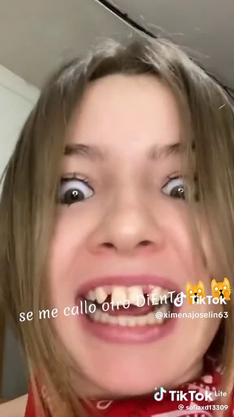 Humorous Tooth Incident - A Piranha's Tale