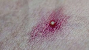 3 ways you should be using witch hazel