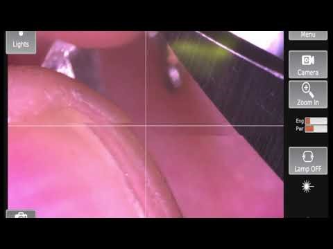 lobster claw spring repair