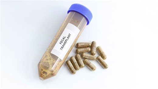 Don’t Give Up On FMT for GI Conditions Beyond C difficile