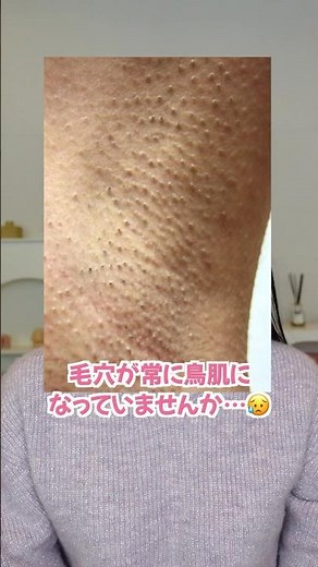 The reason why some people always have goosebumps on the pores under their arms...😵‍💫#pores#hair ...