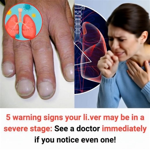 If you notice any of these signs, don't delay—schedule a health check-up right away! 👇👇👇 | Blogtamsu TV