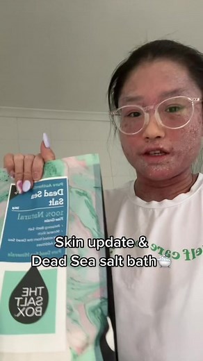 Skin Update & Dead Sea Salt Bath 🛁