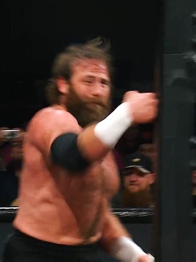 Mark Davis Injured: Possible Hand Break on Ring Post