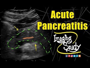 Acute Pancreatitis || Ultrasound || Case 195