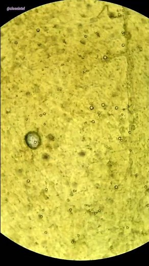 Raw Chicken Under Microscope (Chicken Blood)