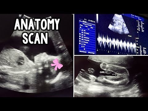 ANATOMY SCAN | 21 WEEKS ULTRASOUND
