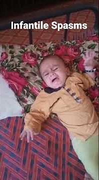Infantile Spasms or Salaam Seizures #seizures #Neonatal_Seizures Drug of Choice Vigabatrin #Sabril