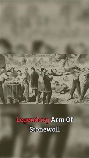 The Moment They Had To Amputate Jackson's Arm #historicalfacts #shocking