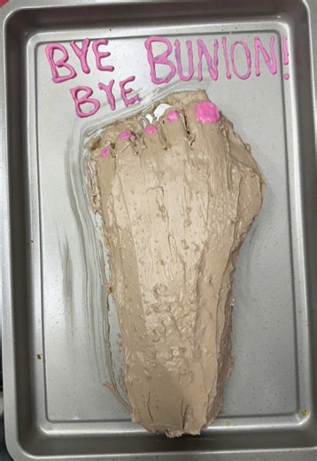 Bye Bye Bunion: Summer Sandals Tips and Care