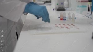 Laboratory determination of blood type. Blood test. Female laboratory assistant makes blood test, blood samples placed in cells on chart to determine the group and Rh factor. Recipient and donor. Stock ビデオ