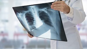 How to Become a Pulmonologist - Career Girls - Explore Careers