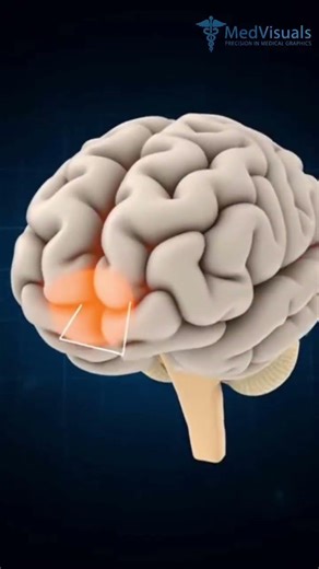 Hypothalamus! Body Mastermind #Hypothalamus#BrainAnatomy#NeuroAnatomy#MedicalShort#AnatomyShorts