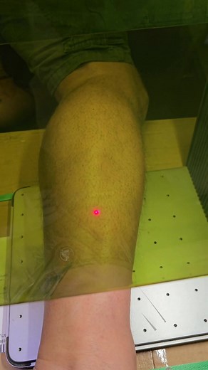 Laser Engraving on Skin: A DIY Tattoo Experience