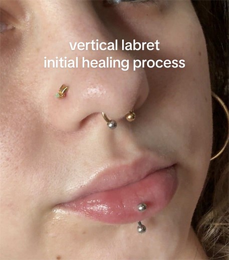 vertical labret healing process 😙 by far my easiest piercing to heal & i did everything i shouldn’t have in the first few days, threw up drinking the night i got it, ate spicy food, kissed, smoked etc. just cleaned it after and it’s been fine. also have been using aquaphor bc i’m addicted (not telling you to do this just being real 🥳) #verticallabret #healingpiercing #lippiercing #piercingaftercare #elpepe