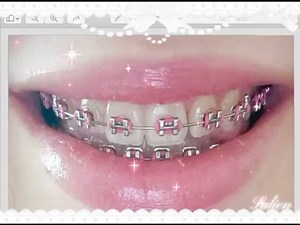 NEOTENOUS *   .. 𝓰et 𝓫races