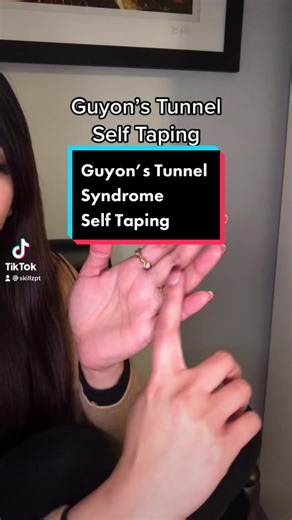 Self Taping for Guyon's Tunnel Syndrome Relief