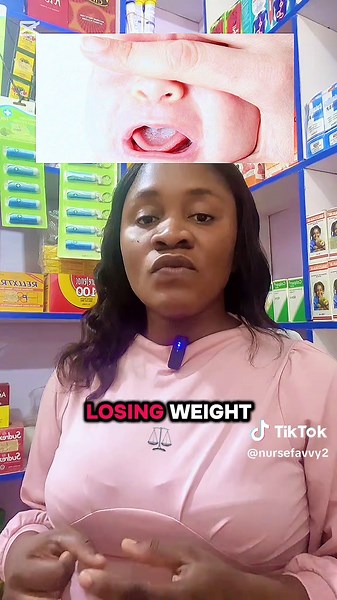 Understanding Oral Thrush in Babies: Causes and Care