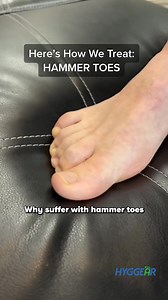 Are your toes feeling cramped and causing discomfort? 🌟 Discover the power of toe realignment with our separators! They gently open up your toes, relieve bunions, and improve circulation. Say goodbye to foot pain and hello to all-day comfort. Try them risk-free today! | Hyggear