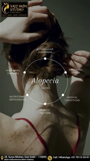 Alopecia: Causes & Treatment #drmanuagarwal #haircare