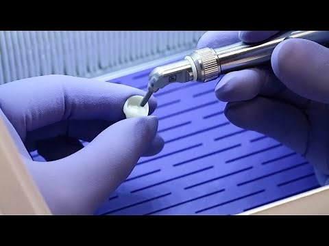 How to use Calibra® Bio Cement in a zirconia restoration | Dentsply Sirona