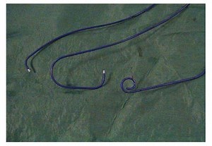 Coronary Angiography Invasive - Private Procedure - LCC