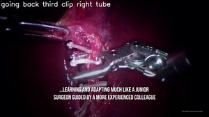 Surgical Robot Performs First Ever Autonomous Gall Bladder Surgery