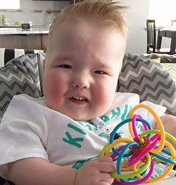 Meet 3 kids alive today thanks to a 3D printer