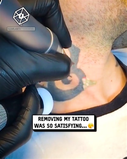881K views · 2.6K reactions | So satisfying to remove my neck tattoo 若✍️ #tattoo | UNILAD | Facebook