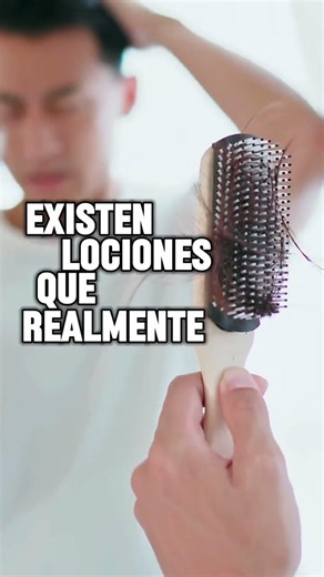 ¿El shampoo detiene la caída del cabello? 😳