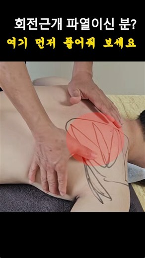 회전근개 파열, 수술 하기전 꼭 여길 풀어보세요