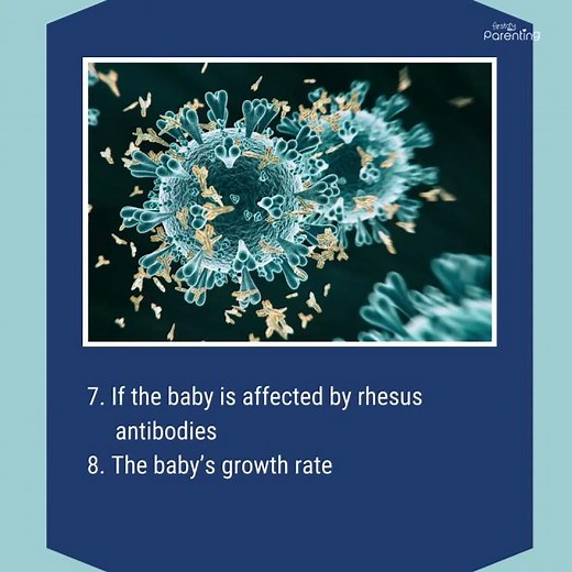 Doppler Scan During Pregnancy - Everything You Need to Know