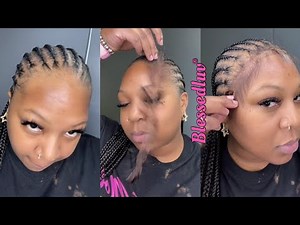 NEW Lace Strips Edges ✅ To Cover Hairline, Baby Hair Strips Lace Frontal