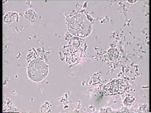 Trichomonas vaginalis