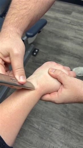 Graston Technique is a form of instrument assisted soft tissue mobilization (IASTM) that treats fascial restrictions as well as muscle and tendon dysfunctions. Injuries Graston can help treat: Carpal tunnel Rotator injuries Plantar Fasciitis Tennis elbow And much more 📞Call 724-240-3016 to schedule an appointment or to find out if Graston Technique can help you!! | Bompiani Spine • Sport