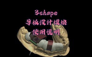 3shape-导板设计模块-使用说明